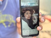 Rickettsia cobra otra víctima en Tijuana: joven lucha por su vida