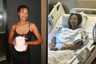 Woman Told She Had Eczema, Until Scans Reveal Shocking Truth