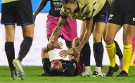 Charlyn Corral sufre escalofriante herida en Duelo de Estrellas vs Barcelona