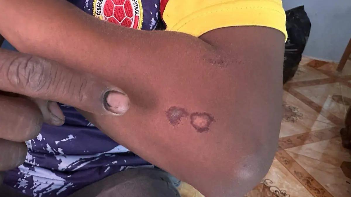 Denuncian presunta agresión de Guardia Nacional contra joven en Irapuato