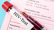 Elevated Leukocyte Counts Signal Diabetes Risk in HIV