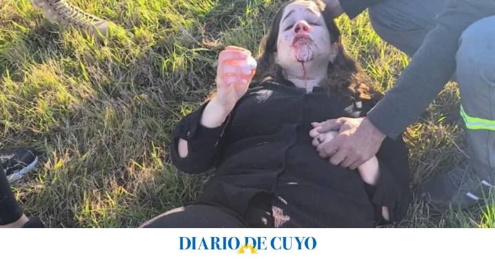 La diputada nacional Rocío Bonacci sufrió un fuerte accidente en Ruta 9