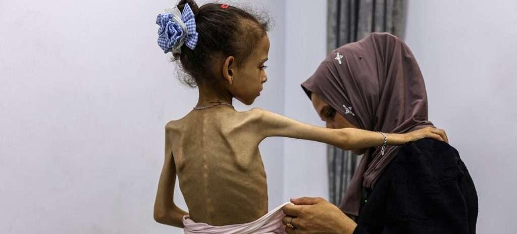 Oficialmente, la ONU declara la hambruna en Gaza