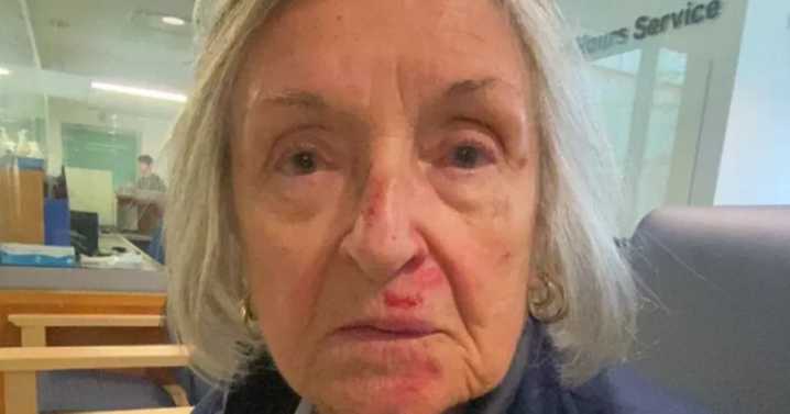 Gran left shaken and too scared to go out alone after horror fall at shopping centre