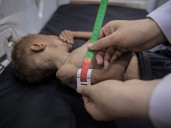 Food alone won’t save Gaza’s starving population