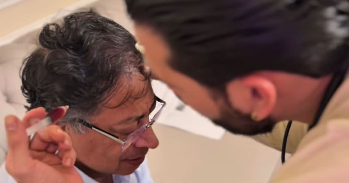 Gustavo Petro recibe un polémico tratamiento en la cabeza: médico aclara de qué se trata