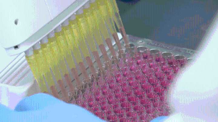 Asthma drug Zileuton could stop serious food allergies