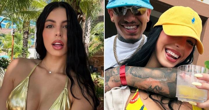 Rachel Arderi muestra el resultado de su cirugía estética en Miami
