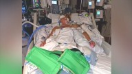 Husband suing medical spa after botched BBL leaves wife fighting for her life