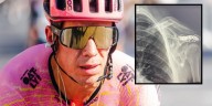 Rigoberto Urán sufrió un accidente y será intervenido quirúrgicamente: esto se sabe