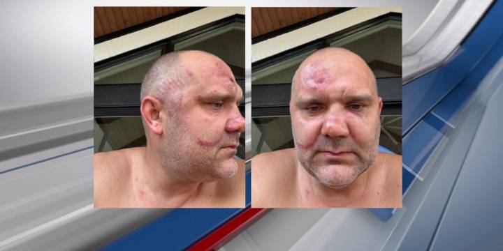 Downtown Cincinnati attack suspect/victim to make first court appearance on charge