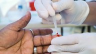 Diagnostican a seis con enfermedades de transmisión sexual cada hora en Puebla