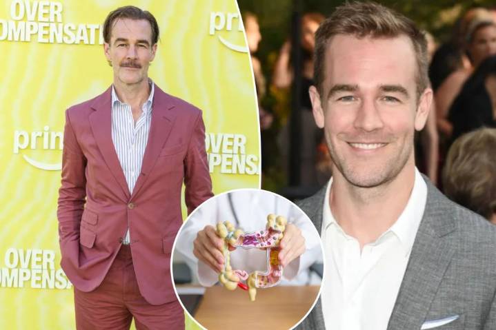 James Van Der Beek reveals colorectal cancer symptom he dismissed