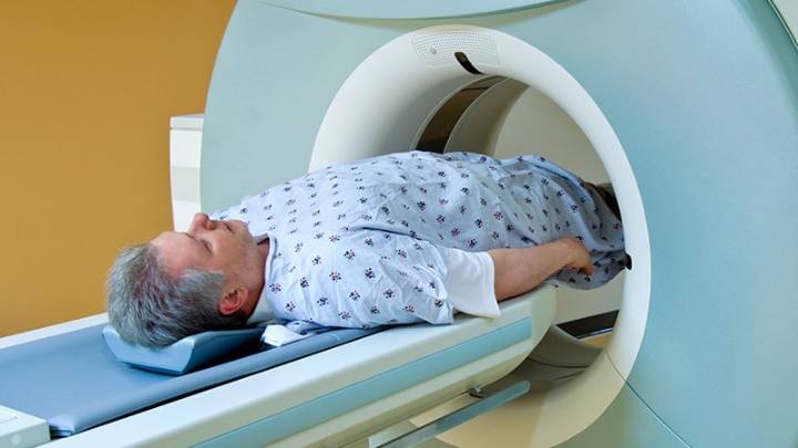 PSA Density Optimises MRI Use in Prostate Cancer Screening