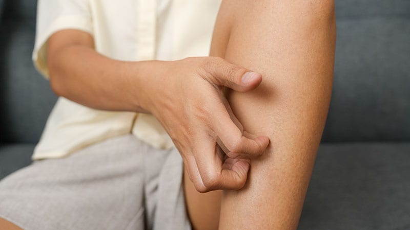 Study Finds Neuropathic Pruritus Has High Comorbidity Burden