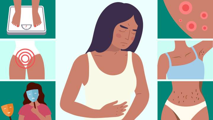 From carb cravings to spots on your jawline - the 8 signs of PCOS you didn't know as 1 in 10 women suffer