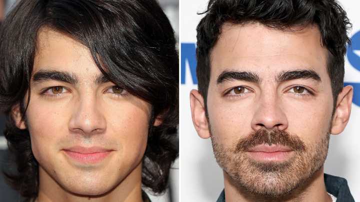 Joe Jonas Good Genes or Good Docs?!