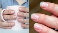 Cómo curar o quitar las manchas blancas en las uñas
