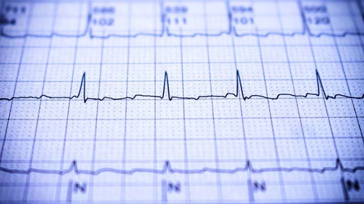 Smartphone App May Simplify Screening of AF in Communities