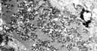 Bat tests positive for rabies in Lincoln County