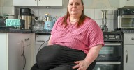 Mom’s massive hernia too dangerous to operate on