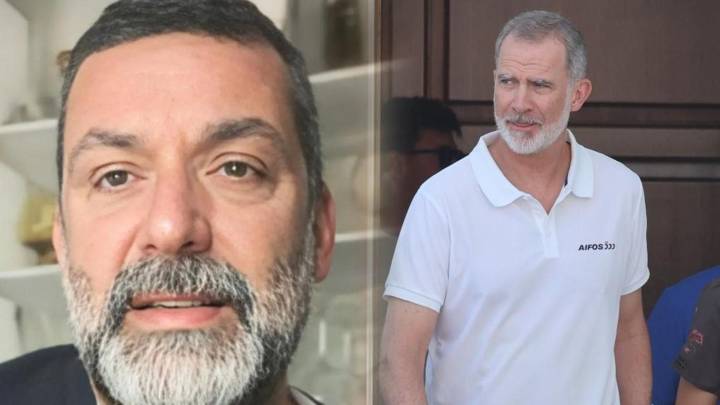 El cantante Jaime Anglada, íntimo amigo del rey Felipe, herido grave tras ser atropellado en Palma de Mallorca