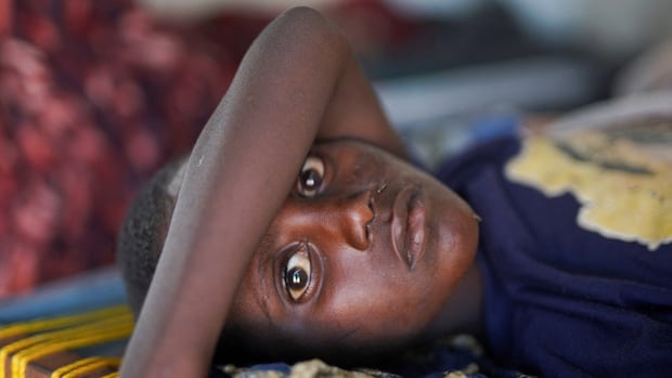 The water's not safe to drink in much of war-torn Sudan. But people have no choice