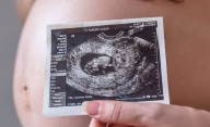 Cómo son los embarazos en robots, que prometen tratamientos de fertilidad