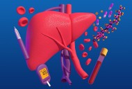 What's New in MASH Treatment?