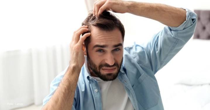 La nueva técnica que promete devolver el cabello sin necesidad de cirugía