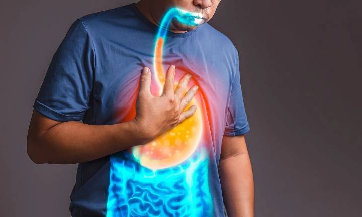 GERD Linked to Increased Incidence of Pulmonary Disease