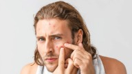 Doctor Warns Popping Pimples In Facial Triangle Could Cause Fatal Infection