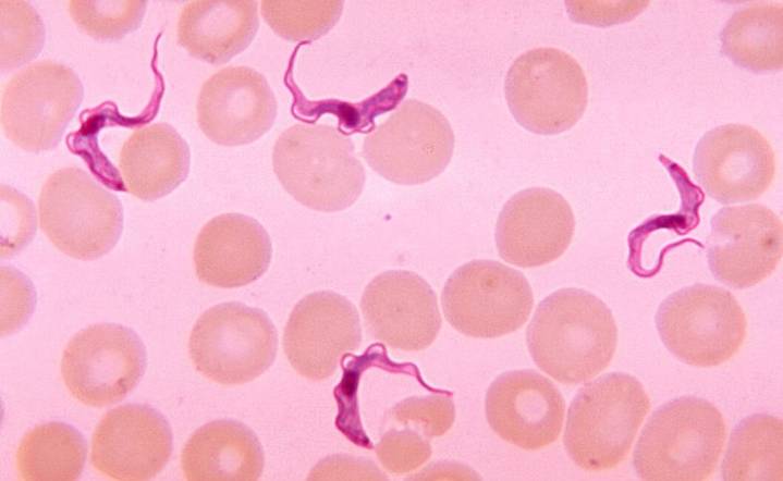 WHO Declares Kenya Free of This Deadly Tropical Parasite After Decades of Suffering