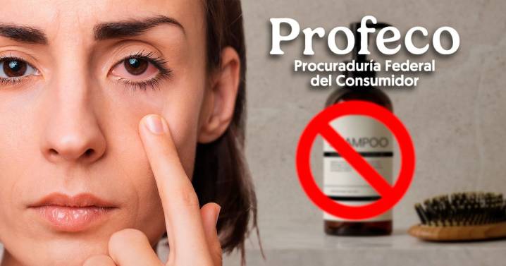 Profeco alerta sobre lote de champú posiblemente contaminado con bacteria; ¿cuál es y cómo identificarlo?