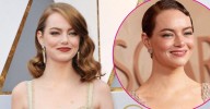 Emma Stone Shocks Fans With Shaved Head: Why the 'Bugonia' Star Chopped Her Hair