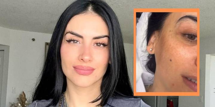 Jessica Cediel respondió las críticas sobre su piel y reveló una condición que padece: “No se me ha acabado la vida”