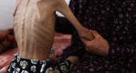 Hambruna en Gaza: Claves de la declaración de la ONU sobre la situación de los palestinos en la Franja de Gaza | Guerra Israel - Hamás en Gaza 