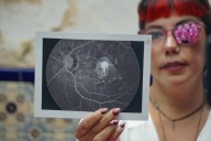 Falta de protección expone a trabajadora del IMSS a enfermedad ocular