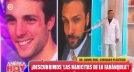 Muestran el antes y después de Nicola Porcella tras su operación de nariz