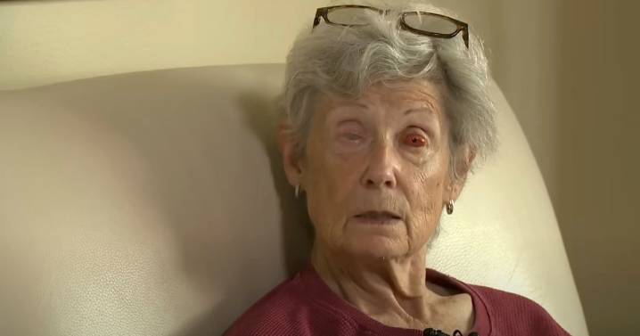 Blind woman can now see through her tooth thanks to bizarre surgery