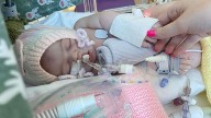 Scientists hail 'sci-fi' treatment for babies with rare condition