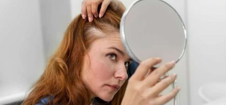 Estas bebidas puede hacer que pierdas mucho cabello