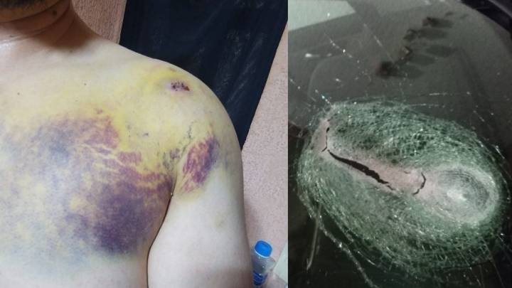 Terror en la autopista Salamanca-León: Hieren a Edgar tras ataque con piedra