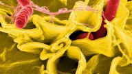 Once personas afectadas por un brote de salmonella en dos hospitales de Gran Canaria