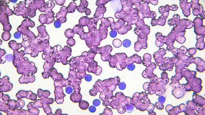 CLL: More Protection, More Problems?