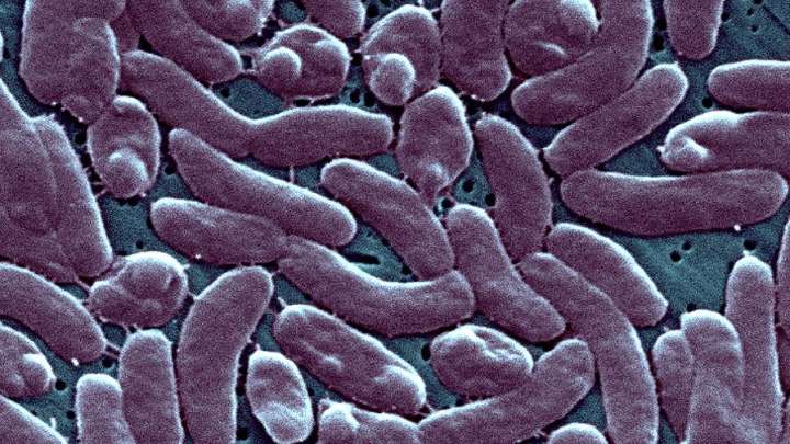 Flesh-eating bacteria has claimed 5 lives in Florida so far this year – NBC 6 South Florida