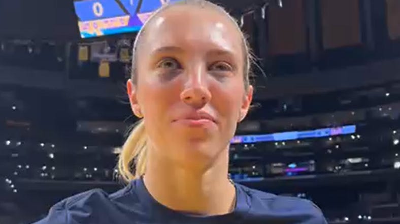 Lexie Hull has two black eyes for the Indiana Fever