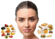 Alimentos que influyen en la aparición del acné