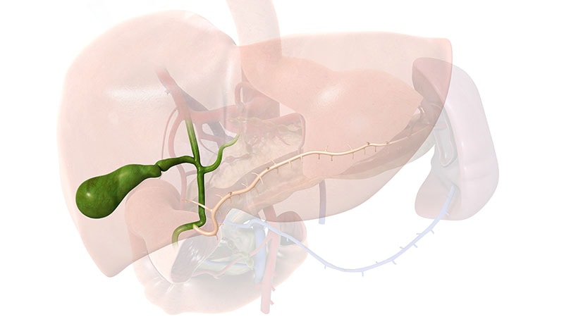 Primary Sclerosing Cholangitis Alters IBD Outcomes in Kids