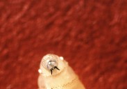 Person in U.S. diagnosed with New World screwworm parasite